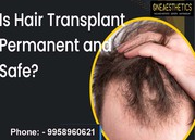 Hair Transplant Surgeon In Gurgaon India