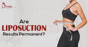 Vaser Liposuction In Delhi & Gurgaon