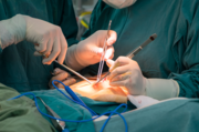 Don’t Suffer in Silence – Get Expert Surgical Help Near You Now!